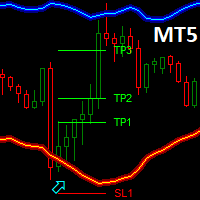 Dark Bands MT5